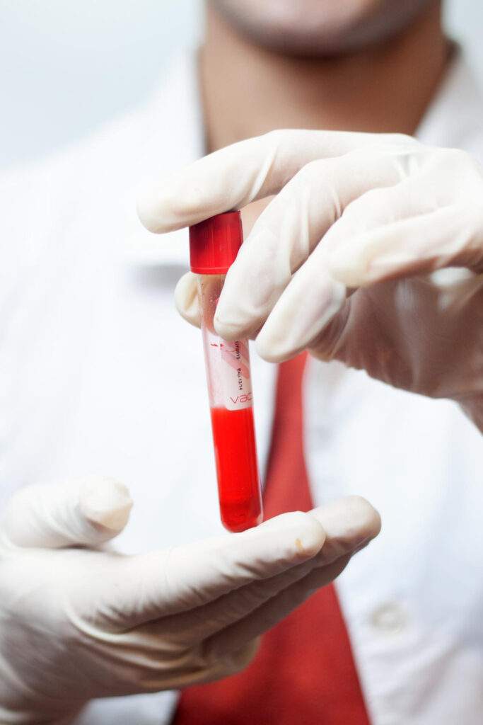 Plasma dental en Amorebieta